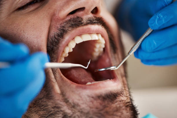 Best Emergency Treatment for Toothache in Humboldt, IA